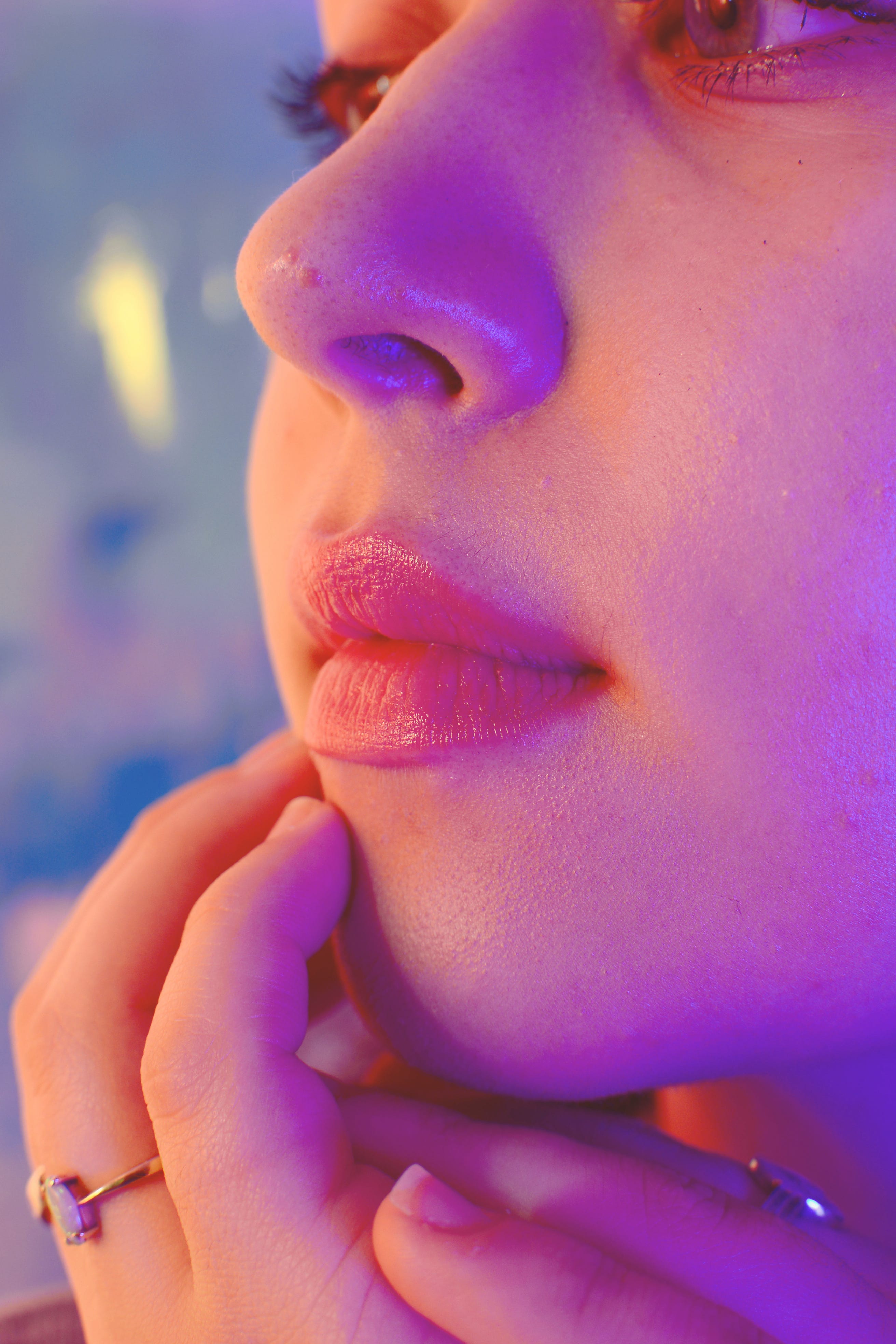 El mejores acne tratamientos naturales para